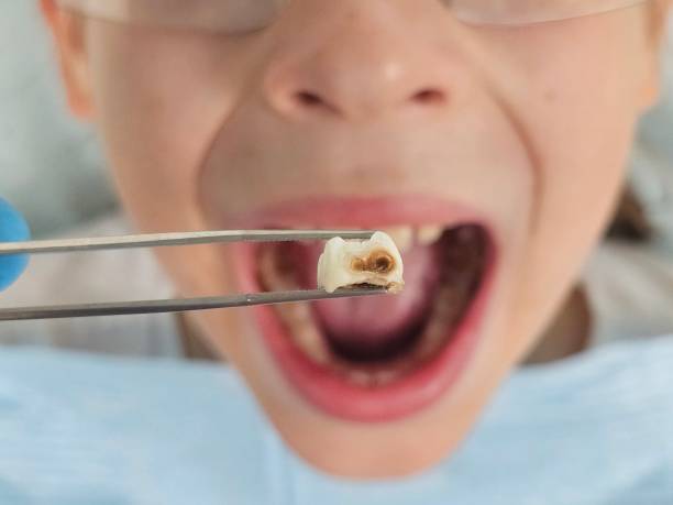 Best Emergency Treatment for Jaw Pain or Injury in Rosemont, PA